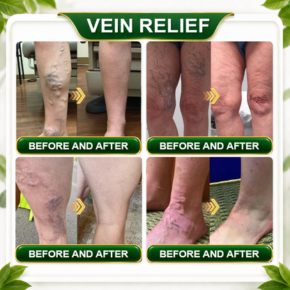 ☘️𝑮𝒓𝒆𝒆𝒏𝑭𝒆𝒆𝒍® 𝑩𝒆𝒓𝒃𝒆𝒓𝒊𝒏𝒆 𝑴𝒐𝒓𝒊𝒏𝒈𝒂- 𝑩𝒆𝒆 𝑽𝒆𝒏𝒐𝒎 𝑫𝒆𝒕𝒐𝒙 𝑺𝒍𝒊𝒎𝒎𝒊𝒏𝒈 𝑭𝒐𝒐𝒕 𝑺𝒐𝒂𝒌 𝑩𝒆𝒂𝒅 𝑼𝒏𝒕𝒆𝒓𝒔𝒕ü𝒕𝒛𝒕 𝑮𝒆𝒘𝒊𝒄𝒉𝒕𝒔𝒎𝒂𝒏𝒂𝒈𝒆𝒎𝒆𝒏𝒕, 𝑳𝒚𝒎𝒑𝒉𝒅𝒓𝒂𝒊𝒏𝒂𝒈𝒆, 𝑮𝒆𝒔𝒖𝒏𝒅𝒆 𝑫𝒖𝒓𝒄𝒉𝒃𝒍𝒖𝒕𝒖𝒏𝒈, 𝑾𝒆𝒊𝒃𝒍𝒊𝒄𝒉𝒆𝒔 𝑾𝒐𝒉𝒍𝒃𝒆𝒇𝒊𝒏𝒅𝒆𝒏 & 𝑺𝒕𝒓𝒂𝒇𝒇𝒆𝒓 𝑨𝒖𝒔𝒔𝒆𝒉𝒆𝒏𝒅𝒆 𝑯𝒂𝒖𝒕🔥