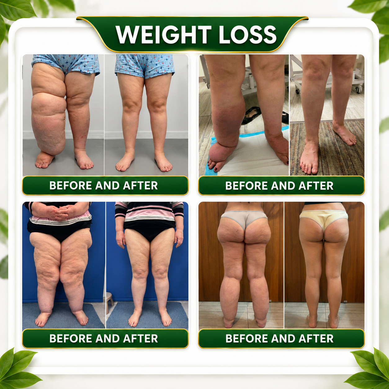 ☘️𝑮𝒓𝒆𝒆𝒏𝑭𝒆𝒆𝒍® 𝑩𝒆𝒓𝒃𝒆𝒓𝒊𝒏𝒆 𝑴𝒐𝒓𝒊𝒏𝒈𝒂- 𝑩𝒆𝒆 𝑽𝒆𝒏𝒐𝒎 𝑫𝒆𝒕𝒐𝒙 𝑺𝒍𝒊𝒎𝒎𝒊𝒏𝒈 𝑭𝒐𝒐𝒕 𝑺𝒐𝒂𝒌 𝑩𝒆𝒂𝒅 𝑼𝒏𝒕𝒆𝒓𝒔𝒕ü𝒕𝒛𝒕 𝑮𝒆𝒘𝒊𝒄𝒉𝒕𝒔𝒎𝒂𝒏𝒂𝒈𝒆𝒎𝒆𝒏𝒕, 𝑳𝒚𝒎𝒑𝒉𝒅𝒓𝒂𝒊𝒏𝒂𝒈𝒆, 𝑮𝒆𝒔𝒖𝒏𝒅𝒆 𝑫𝒖𝒓𝒄𝒉𝒃𝒍𝒖𝒕𝒖𝒏𝒈, 𝑾𝒆𝒊𝒃𝒍𝒊𝒄𝒉𝒆𝒔 𝑾𝒐𝒉𝒍𝒃𝒆𝒇𝒊𝒏𝒅𝒆𝒏 & 𝑺𝒕𝒓𝒂𝒇𝒇𝒆𝒓 𝑨𝒖𝒔𝒔𝒆𝒉𝒆𝒏𝒅𝒆 𝑯𝒂𝒖𝒕🔥