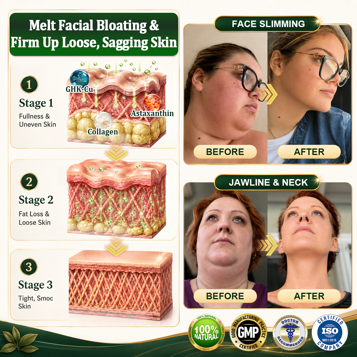 ☘️𝑮𝒓𝒆𝒆𝒏𝑭𝒆𝒆𝒍® 𝑩𝒆𝒓𝒃𝒆𝒓𝒊𝒏𝒆 𝑴𝒐𝒓𝒊𝒏𝒈𝒂- 𝑩𝒆𝒆 𝑽𝒆𝒏𝒐𝒎 𝑫𝒆𝒕𝒐𝒙 𝑺𝒍𝒊𝒎𝒎𝒊𝒏𝒈 𝑭𝒐𝒐𝒕 𝑺𝒐𝒂𝒌 𝑩𝒆𝒂𝒅 𝑼𝒏𝒕𝒆𝒓𝒔𝒕ü𝒕𝒛𝒕 𝑮𝒆𝒘𝒊𝒄𝒉𝒕𝒔𝒎𝒂𝒏𝒂𝒈𝒆𝒎𝒆𝒏𝒕, 𝑳𝒚𝒎𝒑𝒉𝒅𝒓𝒂𝒊𝒏𝒂𝒈𝒆, 𝑮𝒆𝒔𝒖𝒏𝒅𝒆 𝑫𝒖𝒓𝒄𝒉𝒃𝒍𝒖𝒕𝒖𝒏𝒈, 𝑾𝒆𝒊𝒃𝒍𝒊𝒄𝒉𝒆𝒔 𝑾𝒐𝒉𝒍𝒃𝒆𝒇𝒊𝒏𝒅𝒆𝒏 & 𝑺𝒕𝒓𝒂𝒇𝒇𝒆𝒓 𝑨𝒖𝒔𝒔𝒆𝒉𝒆𝒏𝒅𝒆 𝑯𝒂𝒖𝒕🔥